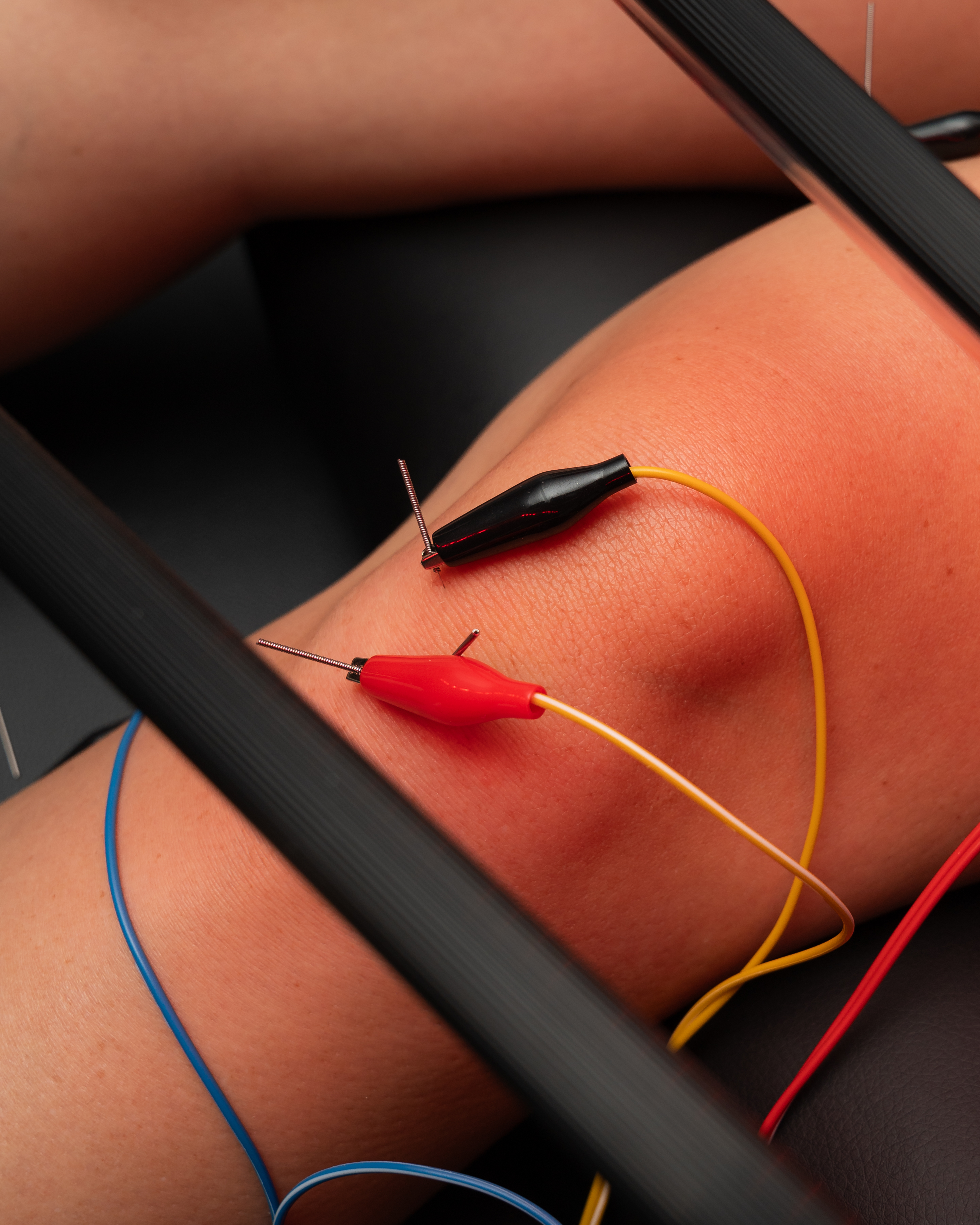 General Physical Therapy